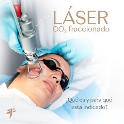 laserC02_web01-100
